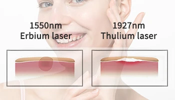 1927 nm Thulium-Laser vs. 1550 nm Erbium-Laser: Was ist der Unterschied?